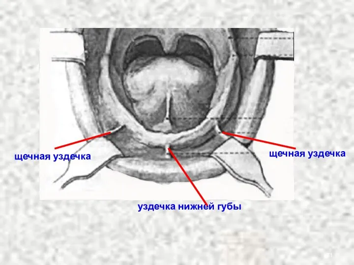 уздечка нижней губы щечная уздечка щечная уздечка