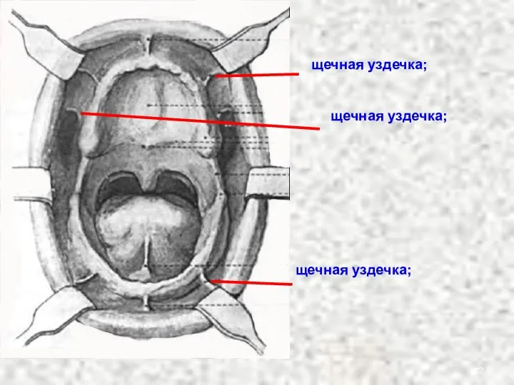 щечная уздечка; щечная уздечка; щечная уздечка;