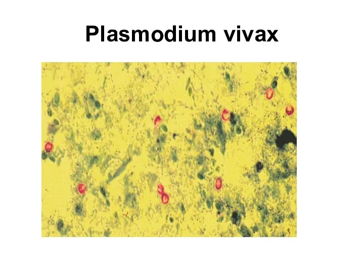 Plasmodium vivax