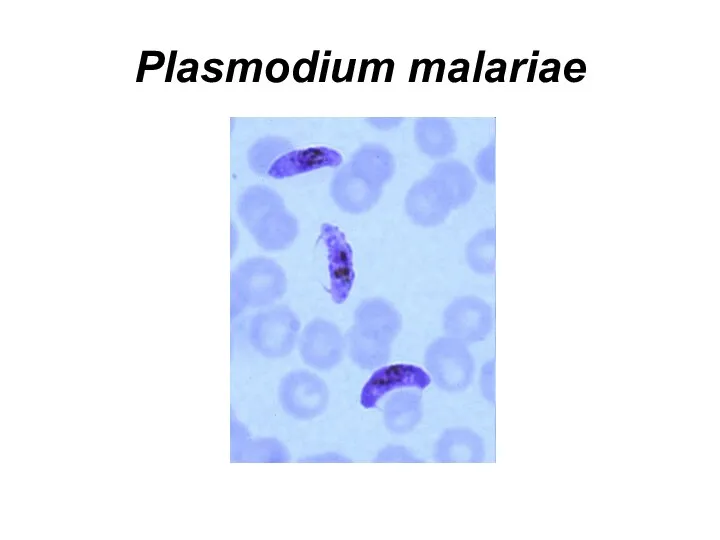 Plasmodium malariae