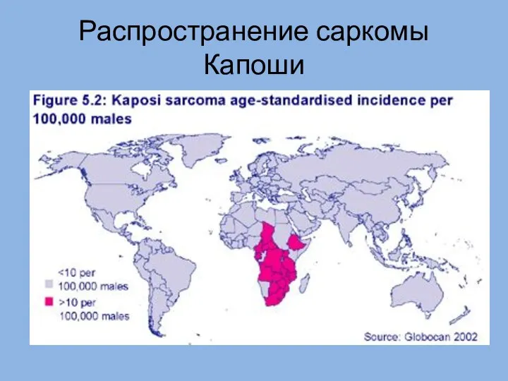 Распространение саркомы Капоши