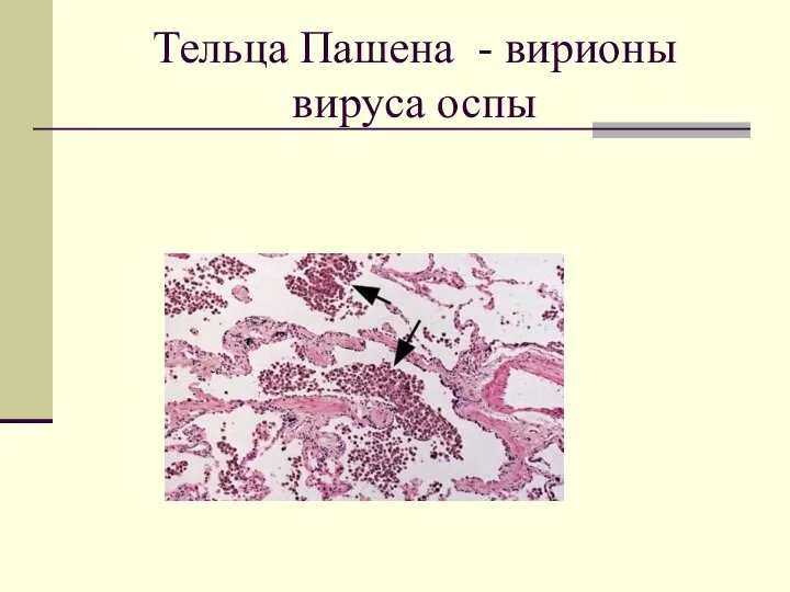 Тельца Пашена - вирионы вируса оспы