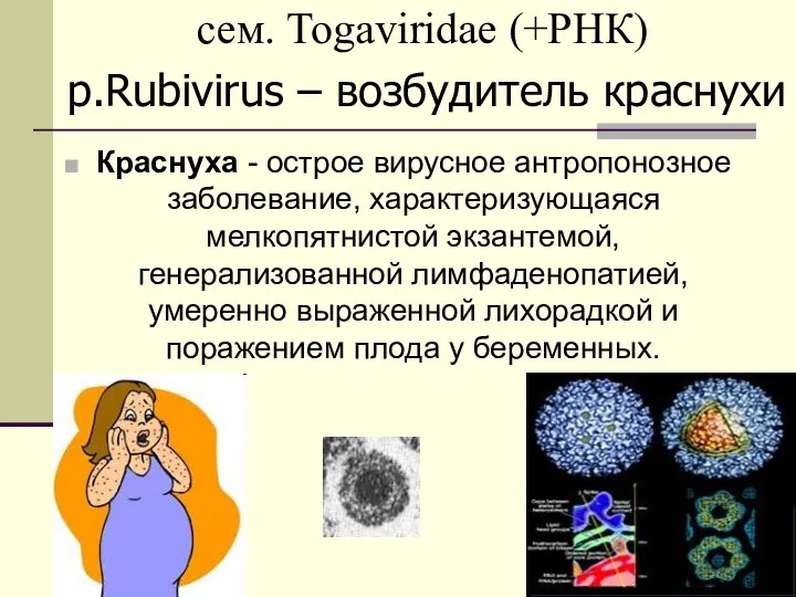 сем. Togaviridae (+РНК) Краснуха - острое вирусное антропонозное заболевание, характеризующаяся мелкопятнистой