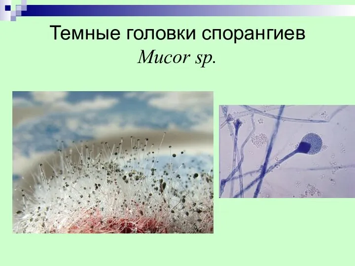 Темные головки спорангиев Mucor sp.