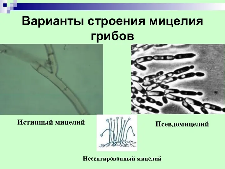 Варианты строения мицелия грибов Истинный мицелий Псевдомицелий Несептированный мицелий