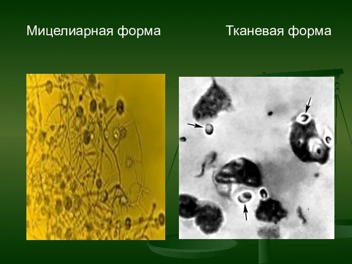 Мицелиарная форма Тканевая форма