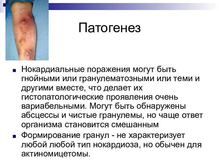 Патогенез Нокардиальные поражения могут быть гнойными или гранулематозными или теми и