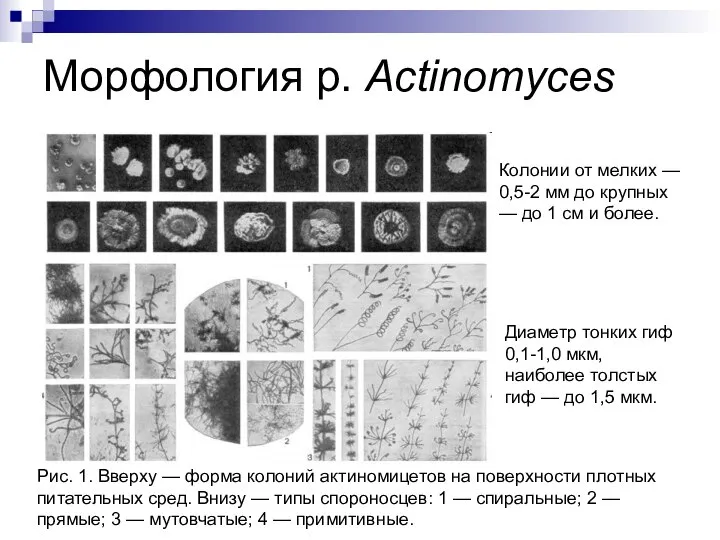 Морфология р. Actinomyces Рис. 1. Вверху — форма колоний актиномицетов на