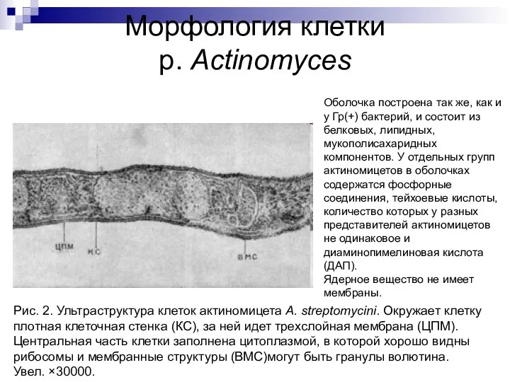 Морфология клетки р. Actinomyces Рис. 2. Ультраструктура клеток актиномицета A. streptomycini.