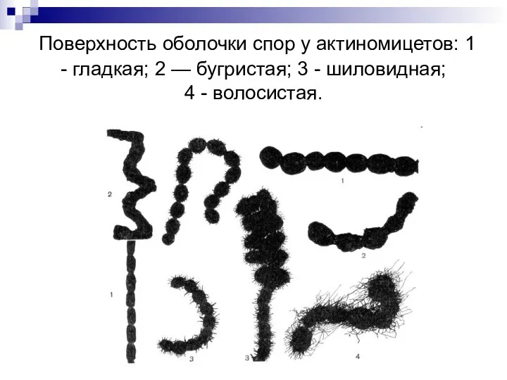 Поверхность оболочки спор у актиномицетов: 1 - гладкая; 2 — бугристая;