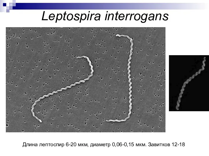 Leptospira interrogans Длина лептоспир 6-20 мкм, диаметр 0,06-0,15 мкм. Завитков 12-18