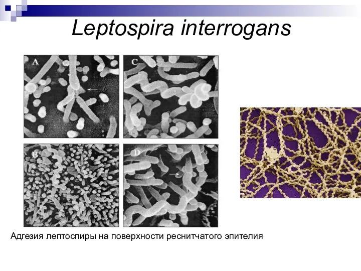 Leptospira interrogans Адгезия лептоспиры на поверхности реснитчатого эпителия