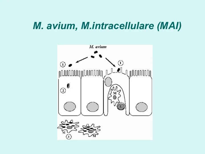 M. avium, M.intracellulare (MAI)