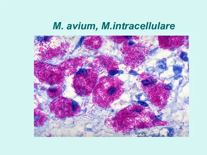 M. avium, M.intracellulare