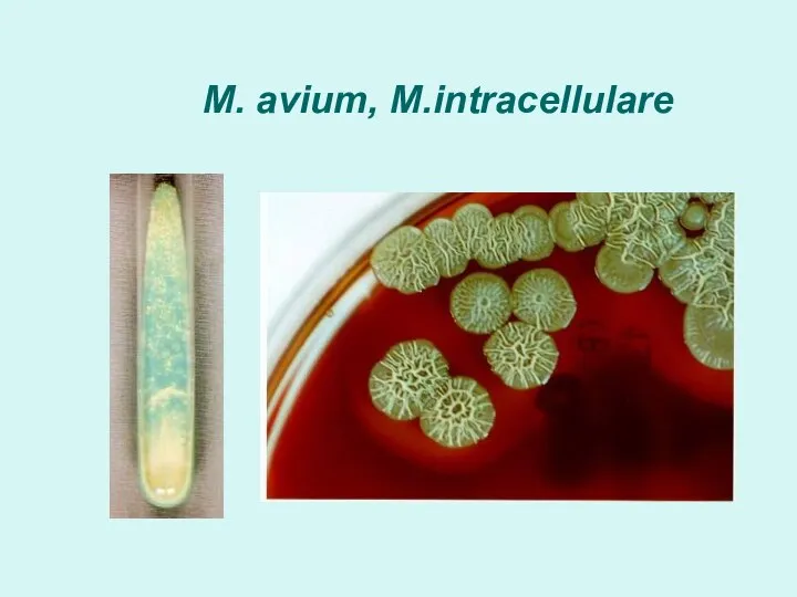 M. avium, M.intracellulare