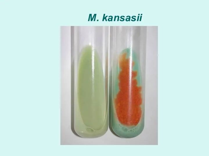 M. kansasii