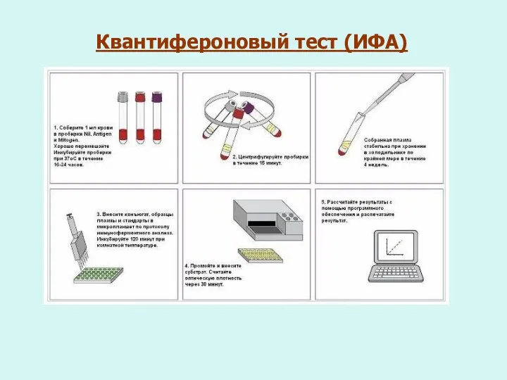 Квантифероновый тест (ИФА)