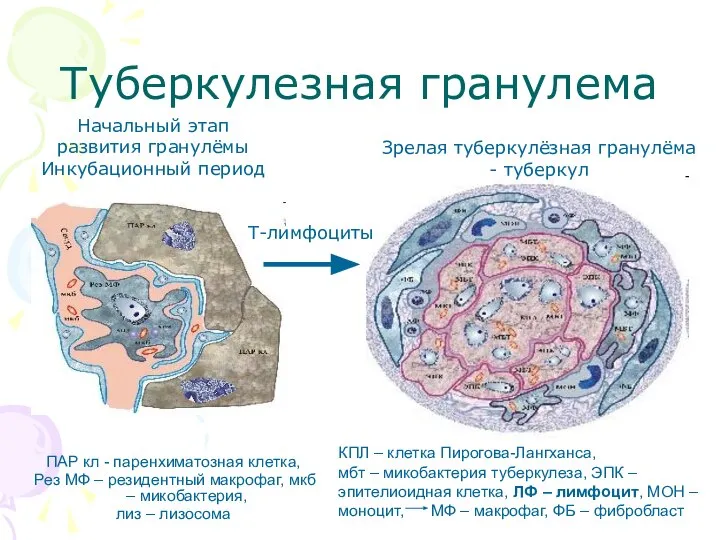 Туберкулезная гранулема ПАР кл - паренхиматозная клетка, Рез МФ – резидентный