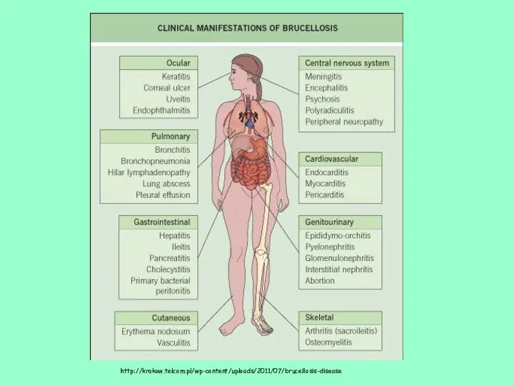 http://krakow.telcom.pl/wp-content/uploads/2011/07/brucellosis-disease