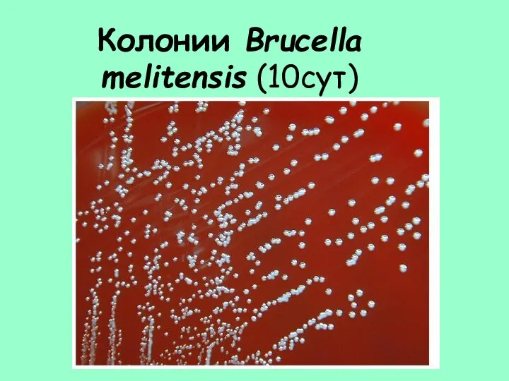 Колонии Brucella melitensis (10сут)