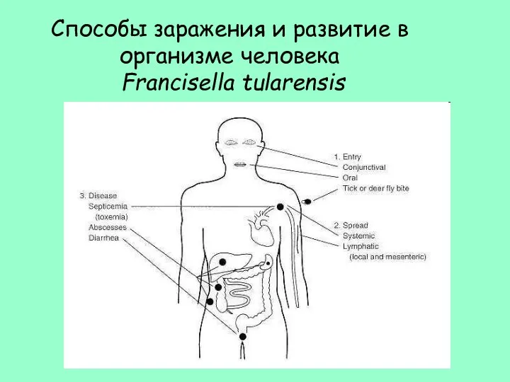 Способы заражения и развитие в организме человека Francisella tularensis