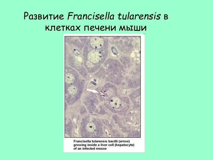 Развитие Francisella tularensis в клетках печени мыши