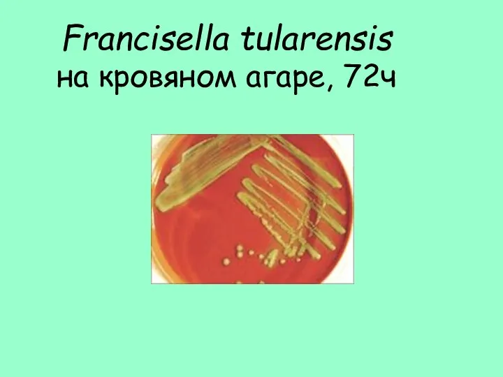 Francisella tularensis на кровяном агаре, 72ч