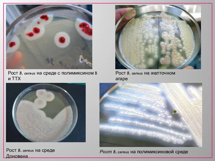 Рост B. cereus на среде с полимиксином B и ТТХ Рост