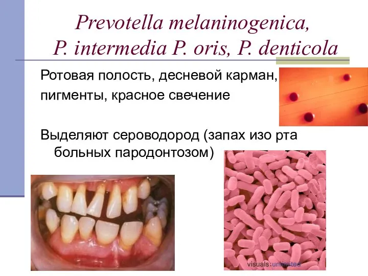 Prevotella melaninogenica, P. intermedia P. oris, P. denticola Ротовая полость, десневой