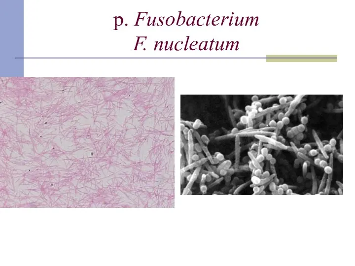 p. Fusobacterium F. nucleatum