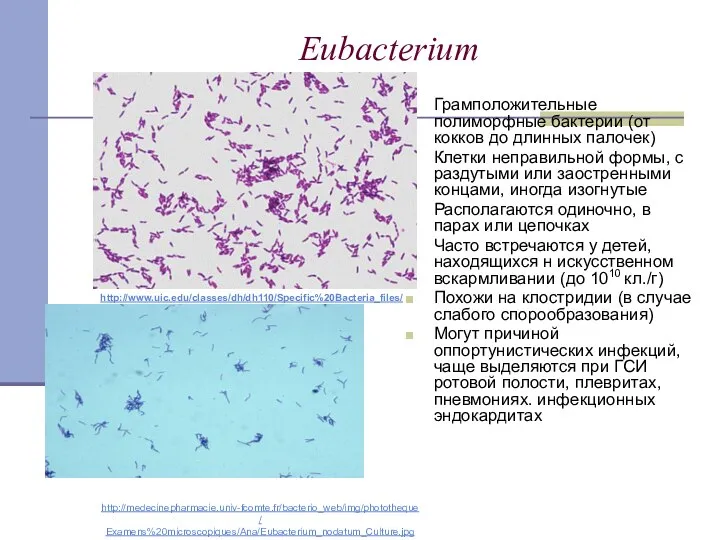 Eubacterium Грамположительные полиморфные бактерии (от кокков до длинных палочек) Клетки неправильной