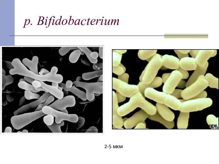 p. Bifidobacterium 2-5 мкм