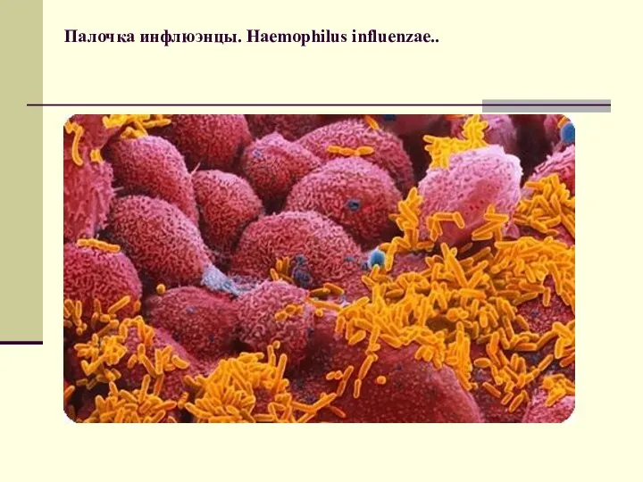 Палочка инфлюэнцы. Haemophilus influenzae..