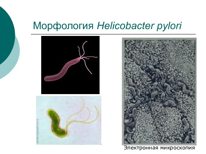 Морфология Helicobacter pylori Электронная микроскопия