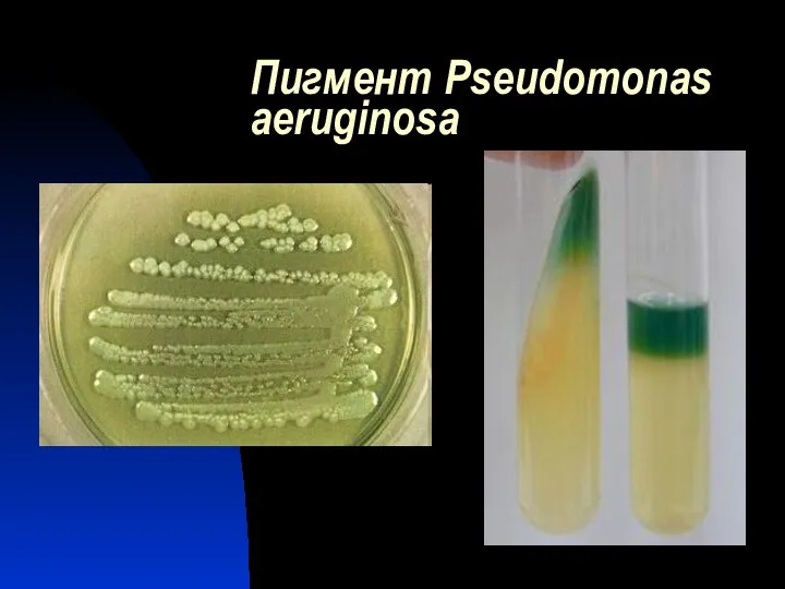 Пигмент Pseudomonas aeruginosa