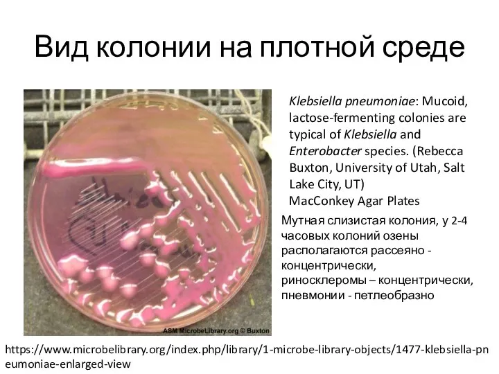 Вид колонии на плотной среде Klebsiella pneumoniae: Mucoid, lactose-fermenting colonies are