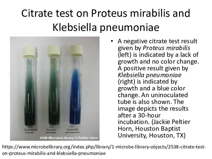 Citrate test on Proteus mirabilis and Klebsiella pneumoniae A negative citrate