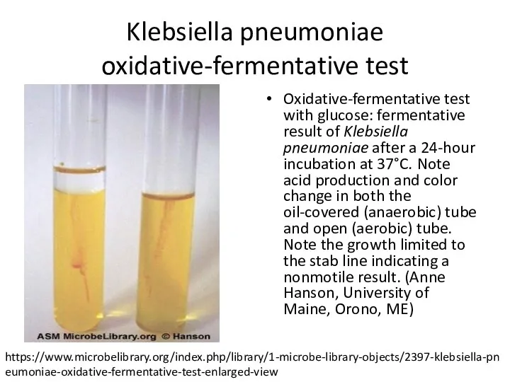 Klebsiella pneumoniae oxidative-fermentative test Oxidative-fermentative test with glucose: fermentative result of
