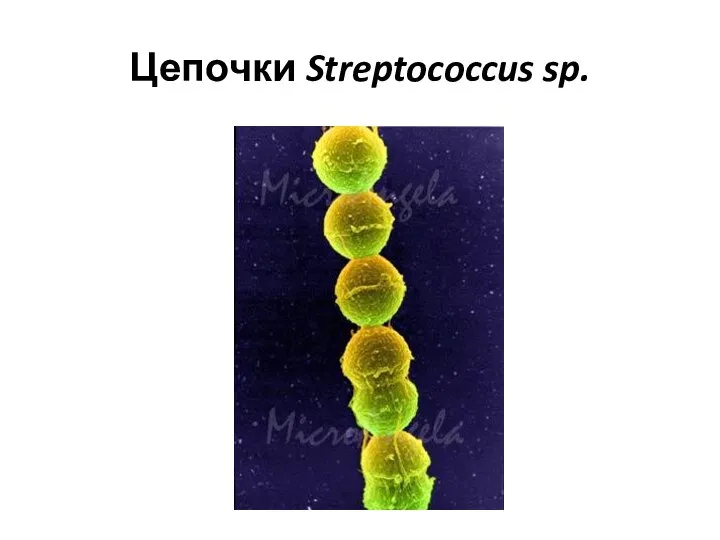 Цепочки Streptococcus sp.