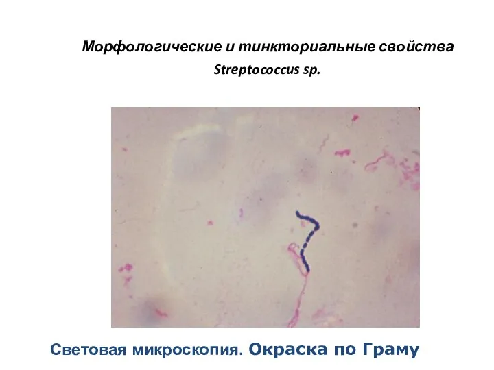 Морфологические и тинкториальные свойства Streptococcus sp. Световая микроскопия. Окраска по Граму