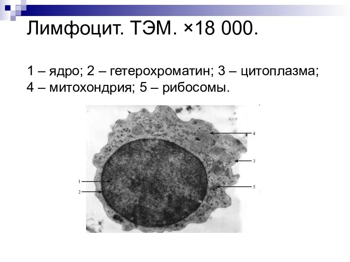 Лимфоцит. ТЭМ. ×18 000. 1 – ядро; 2 – гетерохроматин; 3
