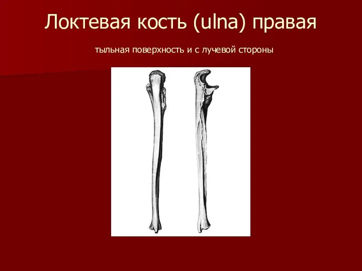 Локтевая кость (ulna) правая тыльная поверхность и с лучевой стороны