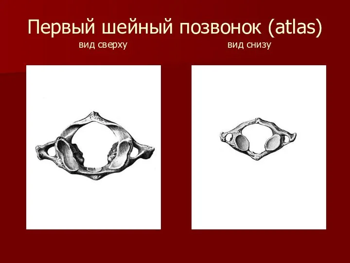 Первый шейный позвонок (atlas) вид сверху вид снизу