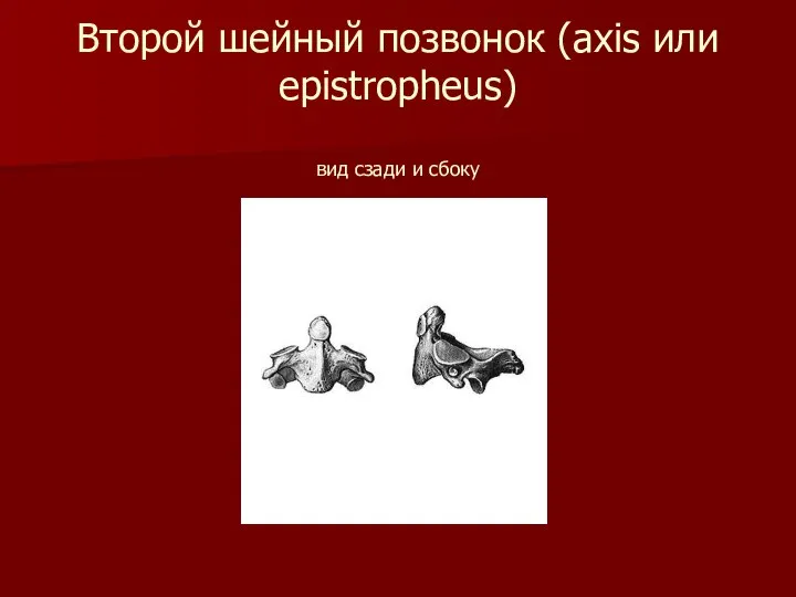 Второй шейный позвонок (axis или epistropheus) вид сзади и сбоку