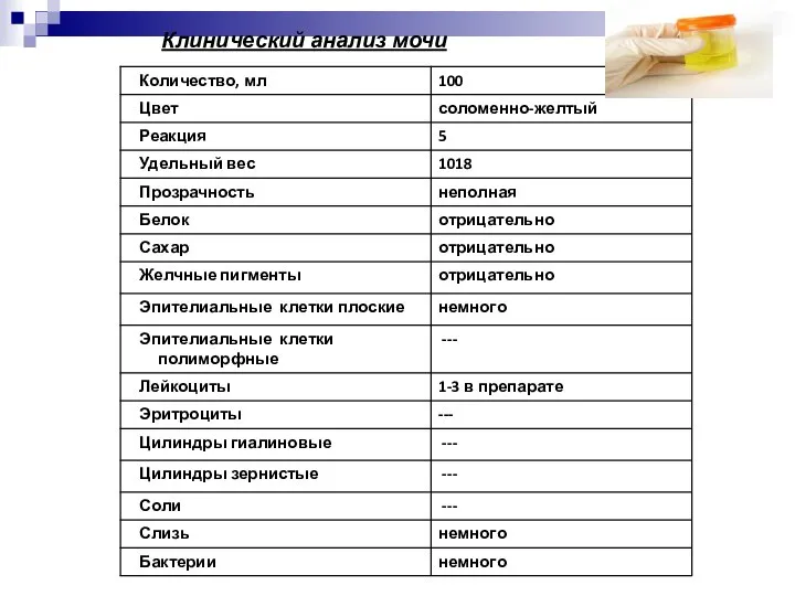 Клинический анализ мочи