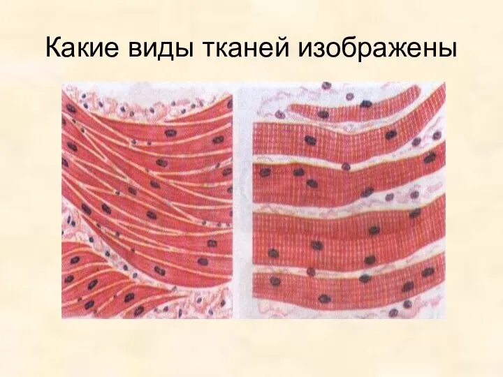 Какие виды тканей изображены