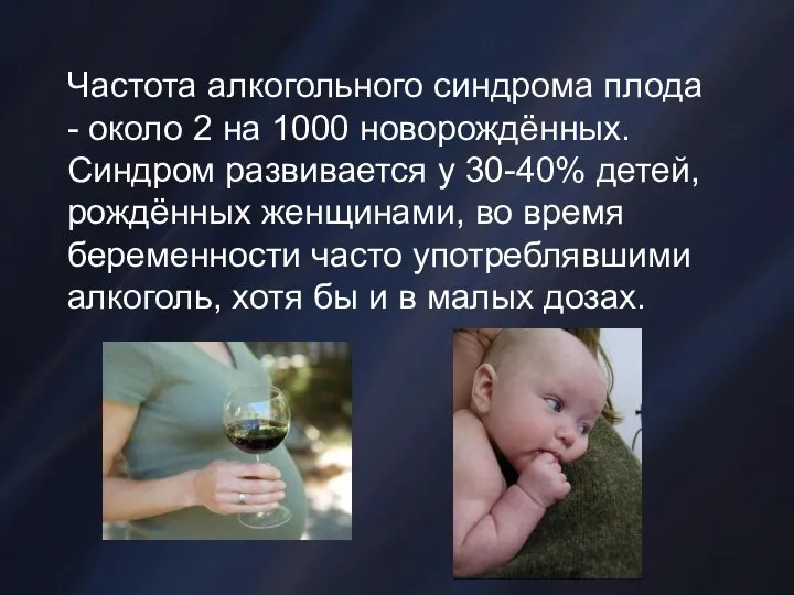Частота алкогольного синдрома плода - около 2 на 1000 новорождённых. Синдром