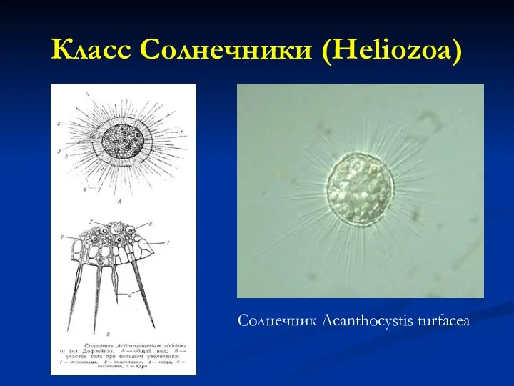 Класс Солнечники (Heliozoa) Солнечник Acanthocystis turfacea