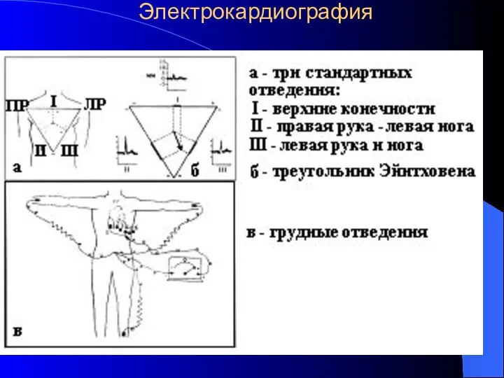 Электрокардиография