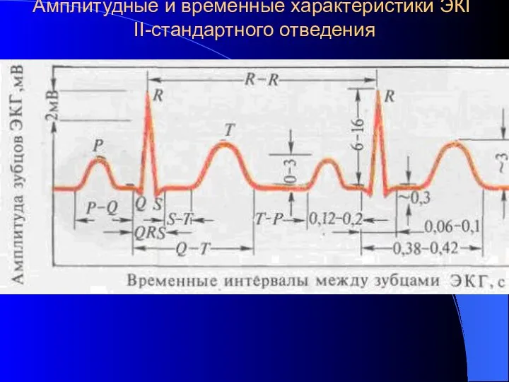 Амплитудные и временные характеристики ЭКГ II-стандартного отведения